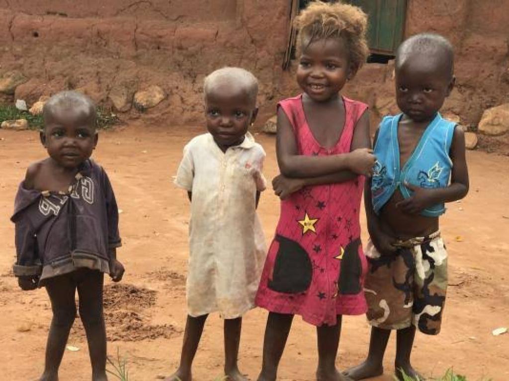 Nord-Kivu : plusieurs enfants touchés par la malnutrition aigüe à Lubero