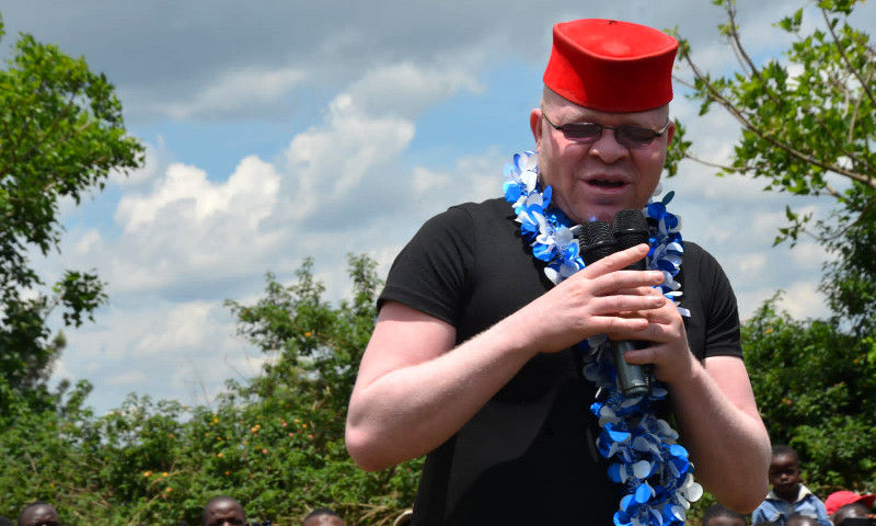 Kenya : Martin Wanyonyi devient le premier homme atteint d'albinisme élu député